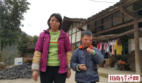 古蔺：一位命运多舛母亲的求助 给我孩子一张笑脸