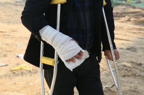 河北定州市丰源房地产打断讨薪民工手脚 人大代表指挥打人